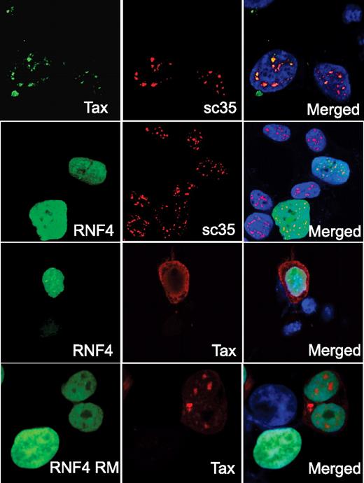 Figure 1. RNF4 expression induces cellular redistribution of Tax. HEK 293T cells were transiently transfected to express RNF4-GFP (RNF4), RNF4-mCherry RING Mutant (RNF4 RM), and/or native Tax (Tax). At 48 hours after transfection, cells were fixed and subjected to immunofluorescence confocal microscopy. RNF4-GFP and RNF4 RM-GFP were detected by direct fluorescence. Tax and sc35 were detected by indirect immunofluorescence using the appropriate anti–rabbit or anti–mouse Alexa Fluor–conjugated secondary Abs. Row 1 shows the expression of native Tax (Tax, green) and endogenous SC35 (sc35, red). Row 2 shows the expression of RNF4-GFP (RNF4, green) and endogenous SC35 (sc35, red). Row 3 shows the expression of RNF4-GFP (RNF4, green) and native Tax (red). Row 4 shows the expression of RNF4 RING mutant (green) and native Tax (Tax, red). Nuclei of cells were counterstained with 4′,6-diamidino-2-phenylindole/TO-PRO (blue). Each row shows expression of the individual protein and an overlay image (Merged).