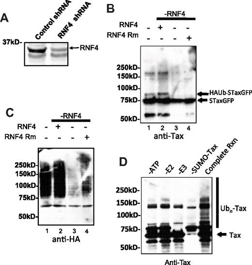 Figure 4. RNF4-mediated ubiquitylation of Tax in vivo. (A) Western blot analysis of endogenous RNF4 expression in RNF4-specific shRNA and control shRNA stably expressing cell lines. The electrophoretic migration of RNF4 is indicated. (B) Analysis of purified S-TaxGFP from HA-ubiquitin–expressing cells. S-TaxGFP was affinity precipitated from transiently transfected control shRNA and RNF4-specific shRNA (RNF4 knockdown) cells. Also shown are samples from Tax-expressing RNF4 knockdown cells that have been cotransfected with RNF4-mCherry or with RNF4-mCherry RM. (C) The same blot was probed with anti-HA Ab. (D) In vitro ubiquitylation of Tax by RNF4. Ubiquitylation reactions were assembled using recombinant, purified MBP-RNF4, SUMO-Tax, and Ubc4. The ubiquitylation assays were halted and separated by SDS PAGE and probed with anti-Tax Ab. Control reactions were assembled in the absence of ATP (−ATP), Ubc4 (−E2), MBP-RNF4 (−E3), or SUMO-Tax (−SUMO-Tax) as indicated. An ubiquitylation reaction with all components (Complete rxn) was also conducted. High-molecular weight adducts corresponding to ubiquitylated Tax is indicated (Ubn-Tax). Unmodified Tax protein (Tax) and molecular weights (in kDa) are indicated.