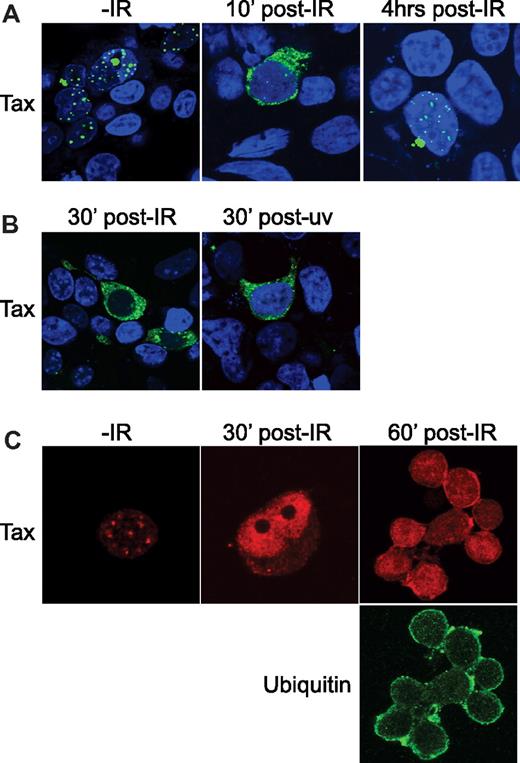 Figure 5. Ionizing radiation induces cytoplasmic accumulation of Tax. (A) HEK 293T cells were transfected to express Tax-GFP (green). Shown is a representative of Tax expression in cells at 40 hours after transfection before exposure (−IR) and at 10 minutes and 4 hours after exposure to 10 Gy of ionizing radiation (post-IR). The nuclei were counterstained with 4′,6-diamidino-2-phenylindole/TO-PRO and the images merged. (B) Tax-expressing HEK 293T cells were exposed to optimal doses of either UV or IR. The nuclei were counterstained with 4′,6-diamidino-2-phenylindole/TO-PRO and the images merged. (C) The HTLV-1–infected T-cell line C8166 was grown to the log phase, plated onto polylysine-coated slides, and prepared for immunofluorescence confocal microscopy. Endogenous Tax (red) was visualized by indirect immunofluorescence confocal microscopy before exposure to IR (−IR) and at 30 minutes and 60 minutes after exposure to 10 Gy (post-IR). At the 60-minute time point, cells were costained for ubiquitin (green).
