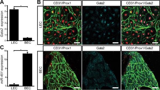 Figure 1. Gata2 mRNA and protein levels are elevated in primary embryonic mouse LECs. (A) Quantification of Gata2 mRNA expression levels assessed by real-time RT-PCR in primary dermal LECs and BECs. Error bars represent mean ± SD of 3 replicates, and data are representative of 3 independent cell isolations from 20 to 30 embryos. (B) Primary dermal LECs and BECs cultured for 3 days on fibronectin and immunostained with CD31 (green), Prox1 (red), and Gata2 (cyan). Scale bar represents 30 μm. (C) Quantification of miR-451 expression levels assessed by real-time RT-PCR in primary dermal LECs and BECs. Error bars represent mean ± SD of 3 replicates, and data are representative of 3 independent cell isolations from 20 to 30 embryos. *P < .05 (Student paired t test).