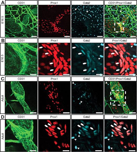 Figure 2. Localization of Gata2 in the lymphatic vasculature. E16.5 (A-B) and adult (C-D) skin immunostained with anti-CD31 (green), Prox1 (red), and Gata2 (cyan) antibodies. Arrows indicate Gata2 localization in lymphatic vascular valves; and arrowheads, Gata2-positive hematopoietic cells. Boxed regions in panels A and C are shown at higher magnification in panels B and D, respectively. Scale bars represent 30 μm (A,C), 10 μm (B), and 15 μm (D).