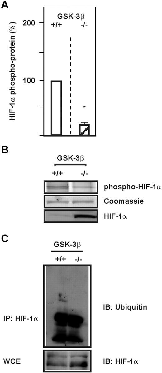 Figure 1. GSK-3β phosphorylates HIF-1α and induces its ubiquitylation. (A) HIF-1α was immunoprecipitated from GSK-3β+/+ and GSK-3β−/− cells and phospho HIF-1α protein levels were measured with the Pro-Q Diamond Phosphoprotein Gel Stain. The phospho HIF-1α protein levels from GSK-3β+/+ cells were set to 100%. Values are means ± SEM of 3 independent experiments. *Significant difference between GSK-3β+/+ versus GSK-3β−/−. (B) Representative Pro-Q Diamond Phosphoprotein Gel Stain analysis. (C) HIF-1α was immunoprecipitated (IP) from GSK-3β+/+ and GSK-3β−/− cells and ubiquitylation was analyzed by immunoblotting (IB) with ubiquitin Abs. WCE indicates whole-cell lysates.