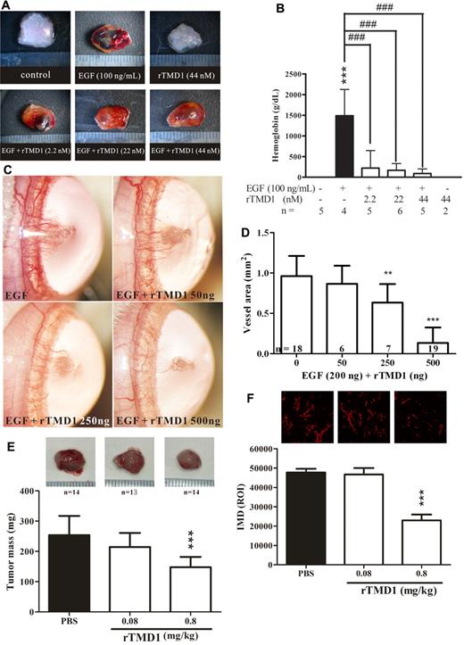 Figure 6. rTMD1 inhibits angiogenesis in vivo. (A-B) Pichia-expressed rTMD1 inhibits angiogenesis in vivo using a murine Matrigel assay. (A) Schematic representation of Matrigel plugs. The magnification bar is 1 mm. (B) Statistical analysis of murine angiogenic assay. The data represent mean ± SD. Similar results were obtained in 3 independent experiments; n represents the number of plugs for each group. ***P < .001 compared with the PBS. ###P < .001 compared with EGF alone. (C-D) rTMD1 inhibits angiogenesis in vivo in a rat corneal micropocket assay. A micropocket in the cornea was surgically generated and implanted with a pellet containing various combinations of 200 ng of EGF and various amounts of Pichia-expressed rTMD1. (C) Corneal photographs were taken 7 days after implantation. Representative figures are shown. (D) Statistical analysis of corneal neovascularization. The data represent mean ± SD. Similar results were obtained in 3 independent experiments; n represents the number of eyes in each group. **P < .01 and ***P < .001 compared with EGF alone. (E-F) rTMD1 inhibits tumor angiogenesis. (E) Lewis lung carcinoma cells (1 × 106) were administered to C57BL/6 mice by subcutaneous dorsal injection. The mice were given daily IP injections of various concentrations of Pichia-expressed rTMD1 for 2 weeks. Representative figures and statistical analyses of tumor mass are shown. ***P < .001 compared with the PBS control. The data represent mean ± SD; n represents the number of mice in each group. (F) Analysis of intratumoral microvessel density (IMD). IMD was detected by CD31 staining. The density of microvessels was quantified in the most vascular areas of the tumor. ***P < .001 compared with the PBS group. The data represent mean ± SD.