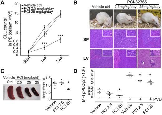 Figure 6. Delayed CLL disease progression by PCI-32765 in TCL1 model. (A) Peripheral blood (100 μL) from mice treated with control vehicle (n = 4), 2.5 (n = 3), or 25 mg/kg/d (n = 4) PCI-32765 were incubated with B220 and CD5 antibodies. Numbers of CLL cells were determined using calibrated counting beads. Results shown are the mean CLL cell counts ± SD with RMANOVA statistic analysis on control versus treated mice. *P < .01, ***P < .0001. (B) All 11 mice were killed 16 days after treatment. Top: example of each group of mice after 16 days of treatment. Spleen (middle) and liver (bottom) tissue sections were assessed histologically after H&E staining. Less lymphocyte infiltration was observed in 25 mg/kg/d PCI-32765 treated mice compared with control mice. (C) Spleens from control or PCI-32765 treated mice were compared for size and weight. The right panel shows the mean spleen weight ± SD with the unpaired t test on control versus treated mice. *P < .05. (D) Spleen cells from mice treated for 16 days with vehicle or PCI-32765 were left untreated (−) or treated with 25μM pervanadate (PVD) for 4 minutes (+). Intracellular staining of phosphorylated PLCγ2 (pPLCγ2) was then performed and analyzed by flow cytometry on gated B220+CD5+ cells. Results are the mean fluorescence intensity (MFI) of phosphorylated-PLCγ2 ± SD with the unpaired t test on control versus treated mice. *P < .05.
