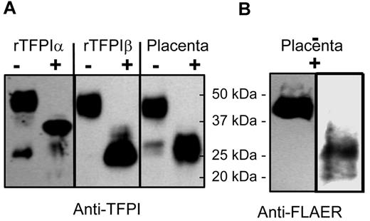 Figure 6. Western blots of placental microsomal TFPI. (A) Recombinant TFPIα, PIPLC-released rTFPIβ, and PIPLC-released TFPI from placental microsomes were affinity purified and then treated without (−) or with (+) degylcosylation enzymes and probed using anti-TFPI polyclonal antibodies. (B) Placental microsomal TFPI treated without (−) or with (+) degylcosylation enzymes and probed with FLAER and anti-FLAER.