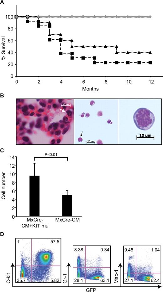 Figure 3. Leukemia development in mice transplanted with Cbfb+/56m; Tg(Mx1-Cre)/KITD816Y/V BM cells. (A) Survival curves of transplanted mice. Black dashed line with squares indicate mice transplanted with Cbfb+/56m; Tg(Mx1-Cre)/KITD816Y BM cells (N = 13); black dotted line with triangles, mice transplanted with Cbfb+/56m; Tg(Mx1-Cre)/KITD816V BM cells (N = 10); gray line with diamonds, mice transplanted with Cbfb+/56m; Tg(Mx1-Cre)/KIT or Cbfb+/56m; Tg(Mx1-Cre)/GFP BM cells (N = 18); and gray dotted line, mice transplanted with KIT (both WT and D816 mutants)–transduced WT BM cells (N = 15). (B) H&E stained lung tissue (left) and Wright Giemsa–stained leukemia cells in PB (middle and right, respectively) from a Cbfb+/56m; Tg(Mx1-Cre)/KITD816Y leukemic mouse. White arrow in the left panel indicates a cell in mitosis. Black arrow in the middle panel indicates a cell that has been enlarged in the right panel. (Imager D2, Zeiss; 20×, 40×, and 63× plan-Apochromat objective lenses; AxioVision 4.8 acquision software; AxioCam HRC, Zeiss). (C) Mitotic cell count from leukemic spleen sections of Cbfb+/56m; Tg(Mx1-Cre) mice (MxCre-CM; N = 3) and Cbfb+/56m; Tg(Mx1-Cre)/KITD816Y (MxCre-CM + KIT mu; N = 3) mice. (D) FACS analysis of PB cells from a leukemic mouse transplanted with Cbfb+/56m; Tg(Mx1-Cre)/KITD816Y BM cells.