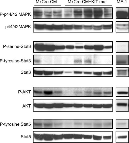 Figure 6. Phosphorylation status of MAPK/Stat3/Stat5/Akt in leukemia cells. Western blot analysis of leukemia cells from Cbfb+/56m; Tg(Mx1-Cre)/KITD816Y (MxCre-CM + KIT mut) mice and Cbfb+/56m; Tg(Mx1-Cre) mice (MxCre-CM) and human ME-1 cells for the indicated proteins and their phosphorylated products.