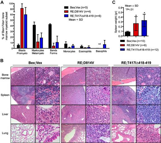 Figure 2. AML blasts in BM and peripheral tissues. (A) Differential counts were performed on Wright-Giemsa–stained cytospins of FACS-purified Bex+Vex+ myeloid scatter-gated cells isolated from BM of control Bex;Vex (n = 5), moribund RE;c-KitD814V (n = 4), and moribund RE;c-KitT417IΔ418-419 (n = 6) mice. Data are mean ± SD (percentages) of the indicated myeloid cell subsets determined by typing 350 to 500 cells per sample. nd indicates not detected. (B) Representative H&E-stained tissue sections of BM, spleen, liver, and lung from Bex;Vex control, leukemic RE;c-KitD814V, and leukemic RE;c-KitT417IΔ418-419 mice. Data are representative of a minimum of 5 moribund RE;c-KitD814V and RE;c-KitT417IΔ418-419 mice. Original magnifications in the left and right columns of Bex;Vex, RE;c-KitD814V, and RE;c-KitT417IΔ418-419 images were ×100 and ×630, respectively. (C) Splenomegaly was observed in all moribund RE;c-KitD814V and RE;c-KitT417IΔ418-419 mice. Spleen weights (grams) are presented as mean ± SD for Bex;Vex controls (n = 10), RE;c-KitD814V (n = 8), and RE;c-KitT417IΔ418-419 (n = 12). *P < .01, compared with Bex;Vex controls (unpaired t test).