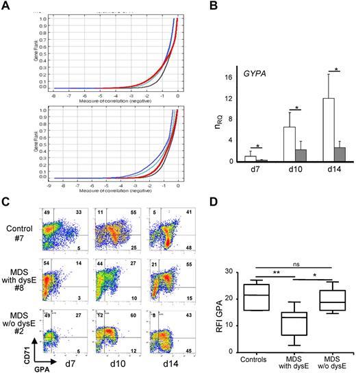 Figure 1. Deregulation of erythroid marker expression in MDS erythroblasts. (A) Gene expression profiling. RNA from MDS with dyserythropoiesis (dysE; n = 5) versus normal (n = 4) cultured erythroblasts are hybridized on Affymetrix gene chip U133A. Neighborhood analysis of data from day 7 shows the probe sets predictive of MDS (red line) versus normal together with curves showing the 50% (black line), 5% (green line), and 1% (blue line) significance levels representing randomly permuted class distinctions. An under-expressed probe set (n = 265) predicts MDS (top panel) with a less than 5 in 100 chances of error, whereas no overexpressed probe set can make the distinction between MDS and normal (bottom panel). (B) RT-qPCR. Quantification of GYPA transcripts in the training and validation sets (9 MDS: ; 7 controls: □), pooled and expressed as mean normalized relative quantity (nRQ) ± SEM (SE) to GAPDH. (C-D) Erythroid differentiation. (C) Representative dual fluorescence histograms of MDS with dysE (n = 30), control (n = 19), and MDS w/o dysE (n = 11) erythroblasts labeled with Abs to CD71 (FL1) and GPA (FL2). Percentages are indicated. (D) Ratio of median fluorescence intensity (RFI) of GPA to isotype per cell at day 14 expressed as box plots: lines within boxes represent the medians (Student t test for P values; *P < .05; **P < .01; ns indicates not significant).