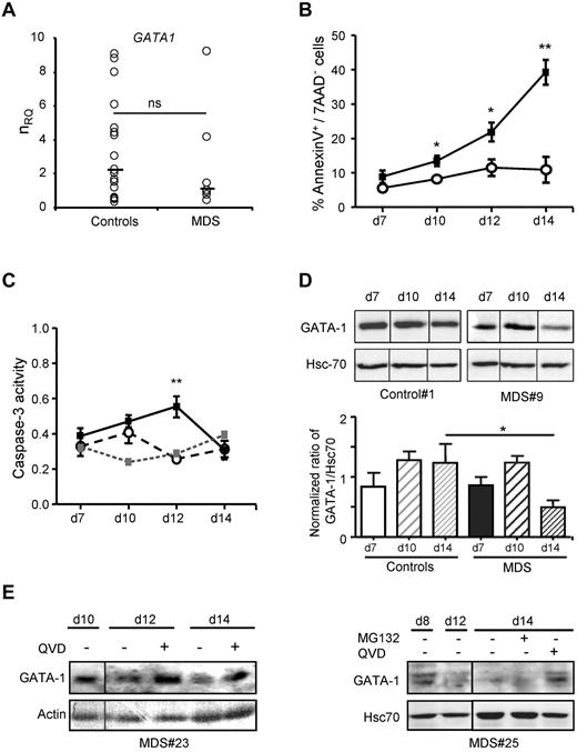 Figure 2. A caspase-mediated cleavage of GATA-1 in MDS erythroblasts. (A) GATA-1 gene expression. RT-qPCR for GATA1 transcripts in MDS versus control erythroblasts. Normalized relative quantity (nRQ) to HPRT. Median values indicated as horizontal bars. (B) Apoptosis. Flow cytometry for annexin V+/7-AAD− cells in MDS (n = 30; ■) and control (n = 22; ○) erythroblasts. Mean percentages ± SE. (C) Caspase-3 activity. Flow cytometry for caspase-3 like activity in MDS (n = 8; ■), pan-caspase inhibitor Q-VD-OPH (100μM)–treated MDS (n = 1; ) and control (n = 4; ○) erythroblasts. Results as mean fluorescence intensity. (D) GATA-1 protein expression. Nuclear fraction proteins blotted with the indicated Abs (top panel). Quantification of GATA-1 by densitometry expressed as a ratio to Hsc70, normalized to the ratio of GATA-1 to Hsc70 in UT-7 control cell line for each blot (bottom panel) in MDS with (n = 11) or without (n = 1) dyserythropoiesis and 8 controls. (E) Inhibition of caspases rescues GATA-1 expression. Q-VD-OPH (100μM) or MG132 (20μM) is added on MDS and control cultures. Immunoblot for GATA-1 in whole-cell lysates. Actin or Hsc70 are used as loading controls. Student t test for P value; *P < .05; **P < .01; ns indicates not significant.