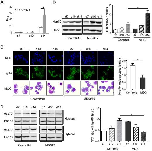 Figure 4. Defective nuclear localization of Hsp70 in MDS erythroblasts. (A) Quantification of HSP701B transcript. RT-qPCR in 9 MDS () and 7 controls (□) erythroblasts, expressed as mean normalized relative quantity (nRQ) ± SE to GAPDH. (B) Immunoblot for Hsp70 in erythroblasts. (Left panel) Whole-cell lysates. Hsc70 as loading control. Representative of 2 separated experiments. (Right panel) Total Hsp70 expression quantified by densitometry as a ratio to Hsc70 normalized to the ratio of Hsp70 to Hsc70 in UT-7 control cell line for each blot. Student t test for P values; *P < .05. (C) Subcellular localization of Hsp70 by immunofluorescence. MDS with (n = 33) or without dyserythropoiesis (n = 11) or control erythroblasts (n = 19) labeled with Ab to Hsp70. DAPI for nuclei. MGG-stained cytospins are shown (left panel). Nucleo/cytosolic (N/C) ratio of Hsp70 expression at day 14 using the ImageJ software (right panel; **P < .01). (D) Immunoblot analysis of Hsp70. Immunoblot for Hsp70 and Hsc 70 in nuclear and cytosolic extracts (left panel) in MDS with (n = 19) or without (n = 3) dyserythropoiesis and controls (n = 9). Quantification by densitometry of N/C ratio of Hsp70 normalized to N/C ratio of Hsc70 (means ± SE; right panel; *P < .05).
