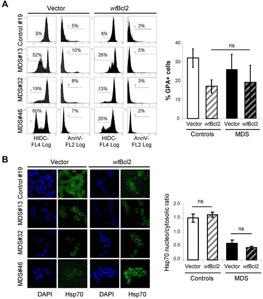 Figure 6. Inhibition of apoptosis does not influence Hsp70 subcellular localization. wtBcl2 was expressed by lentiviral transduction in 9 MDS and 2 control samples. (A) wtBcl2 inhibits apoptosis and delays erythroid cell differentiation. Flow cytometry for mitochondrial membrane depolarization as % HIDClow cells and phosphatidylserine exposure as the percentage of annexin V+ cells in the GFP+ cell population (left panel) and glycophorin A expression as the percentage of positive cells (right panel). (B) Immunofluorescence for Hsp70 in 9 MDS and 2 control erythroblast samples at day 14 of the culture. Representative experiments (1 control and 3 MDS) are shown. Nucleus countercolored with DAPI (left panel). Quantification of Hsp70 nucleo/cytosolic ratio by using the ImageJ software.