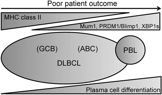 Figure 6. Proposed model of relationship between MHC II expression and DLBCL differentiation. Within the spectrum of DLBCL, there is variation in the expression of markers of plasma cell differentiation. We propose that MHC II expression inversely correlates with markers of plasma cell differentiation and is more commonly lost in cases further along the spectrum toward the plasmablastic lymphomas.