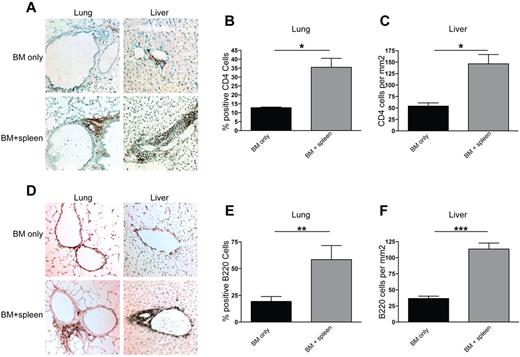 Figure 3. CD4+ T-cell and B220+ B-cell infiltration is seen in lungs and livers of transplanted animals. Liver and lung tissues were harvested at day 60 after transplantation from animals receiving BM only and BM plus splenocytes (BM + spleen) and analyzed by immunohistochemistry and methyl blue counterstaining. Representative images from 3 individual experiments are shown for CD4 (A) and B220 (D). Images were captured with a bright-field microscope at 200× magnification. For lung, infiltration was quantified by obtaining a ratio of CD4+ (B) or B220+ (E) cells to total cells in a 100-mm2 field of view under the microscope. Shown is an average of the count from 4 representative fields. For liver, CD4 (C) and B220 (F) cell infiltration was quantified by counting the number of antibody binding–positive cells and obtaining an average of counts from 4 representative fields. n = 6. *P < .05; **P < .01; ***P < .005.