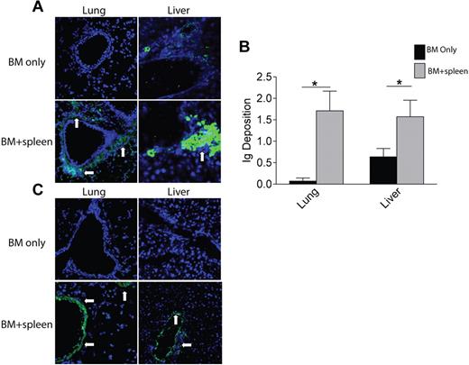 Figure 4. Antibody deposition detected in target areas of lung and liver in diseased animals. Six-micrometer sections of frozen lung and liver tissues harvested at day 60 after transplantation were analyzed by immunofluorescence. Tissues were incubated with FITC-conjugated anti-mouse Ig. (A) Representative images for lung and liver from 3 individual experiments. n = 8. (B) Ig deposition was quantified on a 0-3 scale to determine the amount of antibody in the tissues. (C) Serum from animals given BM only and animals given BM plus splenocytes was collected at day 60 after transplantation and incubated with healthy B10.BR lung and liver tissue followed by FITC-conjugated anti-mouse Ig to detect the presence of tissue-specific antibodies in the serum of diseased animals. White arrows depict areas of Ig deposition. Fluorescence was detected with an Olympus FluoView 500 confocal laser scanning microscope at a magnification of 200×.