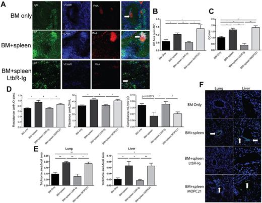 Figure 7. Disruption of GC formation by LTβR-Ig treatment reduces lung dysfunction and cGVHD organ tissue fibrosis. B10.BR recipients were transplanted as per Figure 1. A cohort of animals receiving BM + splenocytes were treated with 200 μg of murine LTβR-Ig or the control Ab, murine MOPC21, every 3 days beginning on day 28 after transplantation until day 52. (A) Spleen tissue harvested from these animals at day 60 was analyzed by immunofluorescence for GC structures. GCs were detected by colocalization of IgM (green), VCAM-1 (blue), and peanut agglutinin (red); merged images show overlap (white) to discriminate GC. White arrows highlight GC. Images were captures with an Olympus FluoView 500 confocal laser scanning microscope at 100× magnification; n = 5. (B) The size of the GC was quantified by measuring the area of peanut agglutinin staining in Photoshop C3. (C) Frequency of GCs was quantified by counting the number of GCs in 1 mm2 of spleen section. (D) PFTs were performed on anesthetized animals on day 60 after transplantation to measure lung function. (E) Animals treated with LTβR-Ig and MOPC21 were examined for fibrosis in the lung and liver. (F) Presence of deposited lung and liver tissue–specific antibodies in animals treated with LTβR-Ig and MOPC21 was determined by immunofluorescence by staining with FITC-conjugated anti–mouse Ig. White arrows depict Ig deposition. Images were captured at 200× magnification and are representative of 2 individual experiments; n = 5. *P < .05; **P < .01.