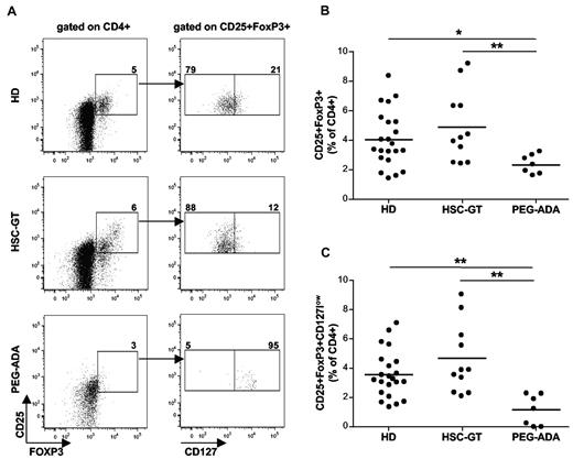 Figure 1. Phenotype of Tregs in ADA-SCID patients after different treatments. (A) Representative FACS staining and gating strategy of Tregs in a pediatric HD, GT, and PEG-ADA–treated patient. Total PBMCs were stained for CD4, CD25, CD127, and FOXP3. Gates were established on the basis of isotype-identical monoclonal antibody controls. Treg frequencies are indicated. (B) Percentage of CD25+FOXP3+ Tregs in the CD4+ gate of 22 HD, 11 GT, and 7 PEG-ADA–treated patients. Horizontal bars indicate mean values. *P < .05. **P < .005. (C) Percentage of Tregs identified by the low or absent expression of CD127 in the CD25+FOXP3+ gate. Horizontal bars indicate mean values. **P < .005.