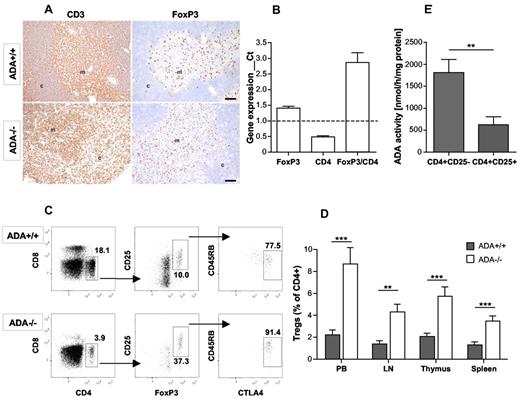 Figure 3. Expansion of the Treg compartment in untreated ADA−/− mice. (A) Anti-CD3 and FoxP3 immunohistochemistry in thymi of 3-week-old ADA+/+ and ADA−/− mice (original magnification ×10). (B) TaqMan gene expression analysis for CD4 and FoxP3 on total thymi of ADA−/− (n = 6) mice compared with ADA+/+ (n = 6). ADA+/+ gene expression was arbitrarily considered 1 as represented by the dashed line. Data are mean ± SD. (C) Representative FACS analysis for CD4+CD25+FoxP3+CTLA4+CD45RBlow Tregs in ADA+/+ and ADA−/− PB. (D) Percentage of CD25+FoxP3+CTLA4+CD45RBlow Tregs in CD4+ compartment in PB, lymph nodes (LN), thymus, and spleen of ADA+/+ (n = 11) and ADA−/− (n = 11) mice. Data are mean ± SD. **P = .005-.0005. ***P ≤ .0005. (E) ADA enzymatic activity in ADA+/+ CD4+CD25− T effector (n = 3) and CD4+CD25+ T regulatory cells (n = 3). Data are mean ± SD. **P = .008.