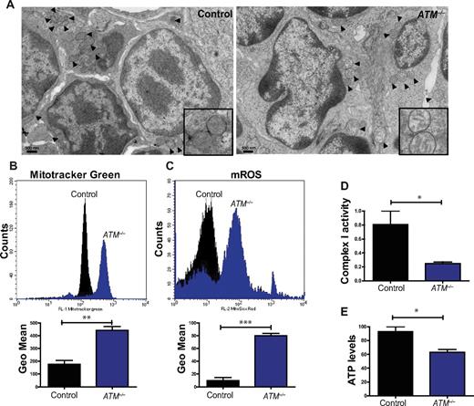 Figure 1. Mitochondrial dysfunction in ATM-null thymocytes. (A) Ultrastructural abnormalities in ATM-deficient thymic cells. Representative pictures taken by transmission electron microscopy in young mice from wild-type or ATM−/− mice. ATM−/− thymic tissue showed a number of mitochondria with disorganized structure and swollen appearance. Arrowheads denote mitochondria. Magnification, × 6000. Boxes show higher magnifications of the mitochondria. (B-C) Increased mitochondrial mass and mROS in ATM−/− thymocytes. Freshly isolated thymic cells were stained with 200nM MitoTracker Green (MTG) probe (B) or 5μM superoxide indicator MitoSOX (C) and analyzed by flow cytometry. Representative histograms of MTG and MitoSOX fluorescence intensity per genotype are illustrated. Graph shows the averaged mean intensity for each genotype (n ≥ 3/group; Student t test: **P ≤ .001, ***P ≤ .0001). (D-E) ATM-deficient thymocytes display reduced activity of complex I of the ETC and diminished levels of cellular ATP. (D) Total protein was extracted from freshly isolated viable thymocytes of 5- to 8-week-old mice of the indicated genotypes. The activity of complex I of the ETC was analyzed using equal amount of protein per sample (Student t test: *P ≤ .02; n ≥ 3/genotype). (E) ATM−/− thymocytes display reductions in cellular ATP levels. Total cellular ATP levels were measured in equal number of freshly isolated viable thymic cells isolated from 5- to 8-week-old mice of the indicated genotypes. Shown are the relative ATP levels for each cohort (Student t test: *P ≤ .02; n ≥ 3/genotype).