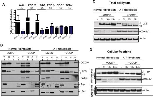 Figure 2. ATM deficiency is associated with abnormal mitophagy, not increased mitochondrial biogenesis. (A) Expression of genes involved in mitochondrial biogenesis is intact in ATM-deficient and wild-type thymocytes. Nrf1, PGC1β, PRC, PGC1α, SOD2, and TFAM mRNAs were measured by reverse transcription real-time PCR analyses. mRNA levels were normalized using Actin mRNA as an internal control. N.S. indicates not statistically significant. (B-D) Accumulation of Parkin and impaired mitophagy in A-T human fibroblasts. (B) Parkin levels are elevated in mitochondria of A-T fibroblasts without induction of mitochondrial damage by CCCP. Normal or A-T human fibroblasts were treated with DMSO or 50μM CCCP for 4 hours, and equal number of cells per sample was submitted to fractionation into mitochondrial (M), cytoplasmic (C), and nuclear (N) subregions. Equal volume of the fractions was analyzed by Western blot for the expression of Parkin, COX-IV (mitochondrial marker), Topoisomerase I (Topo; nuclear marker), LC3 (autophagic marker), and lactate dehydrogenase (LDH; cytoplasmic marker). We also analyzed 20 μg of total (T) protein. The small amount of LC3 present at the nuclear fraction after CCCP treatment is probably because of a residual mitochondrial material that fractionated with the nuclear compartment because CCCP could potentially induce damage to the mitochondrial membrane and thus make these organelles more leaky. (C) Normal or A-T human fibroblasts were treated with DMSO or 50μM CCCP for 3, 16, or 24 hours, and proteins were isolated followed by immunoblotting against COX-IV, LC3 (autophagic marker), and Actin (loading control) in total cell lysate. (D) Normal or A-T human fibroblasts were treated with CCCP as in panel C followed by cellular fractionation as in panel B, and mitochondrial protein fractions were analyzed by immunoblotting against COX-IV and LC3. Actin levels in the cytoplasmic fractions of these samples also were analyzed to verify equal loading based on cell number.