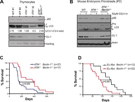 Figure 3. Beclin-1 heterozygosity reverts the induction of macroautophagy and reduced levels of the oxidative sensor DJ-1 in ATM-null cells but delays tumorigenesis in ATM-null mice. (A) Allelic loss of Beclin-1 reverses the increases in autophagic signaling and the reduced levels of DJ-1 manifest in ATM−/− thymocytes. Proteins from freshly isolated thymocytes were analyzed by SDS-PAGE immunoblotting for detection of the autophagic markers p62 and LC3 and the oxidative stress sensor DJ-1. Band intensities of the cytoplasmic (-I) and autophagosome-associated (-II) forms of LC3 were determined using the ImageJ processing program, and the ratio of the LC3-I/LC3-II forms was calculated for each sample. (B) Allelic loss of Beclin-1 reverses the increased autophagic response and the reductions in DJ-1 protein levels observed in early passage ATM−/− MEFs. P2 MEFs were treated with either DMSO or 50μM chloroquine (CQ; Sigma-Aldrich) for 4 hours, and total proteins were analyzed for the autophagic markers p62 and LC3, or for DJ-1. Transient treatment with CQ did not significantly alter p62 expression but affected LC3-I/II conversion in MEFs. (C-D) Allelic loss of Beclin-1 delays death of ATM−/− mice (C), while accelerating onset of B-cell lymphoma in Eμ-Myc–transgenic mice (D). Kaplan-Meier survival plots of mice with desired genotypes are shown. P values were obtained by the log-rank (Mantel-Cox) test. The nonsurviving ATM−/− and ATM−/− Beclin-1+/− all died of T-cell lymphomas.
