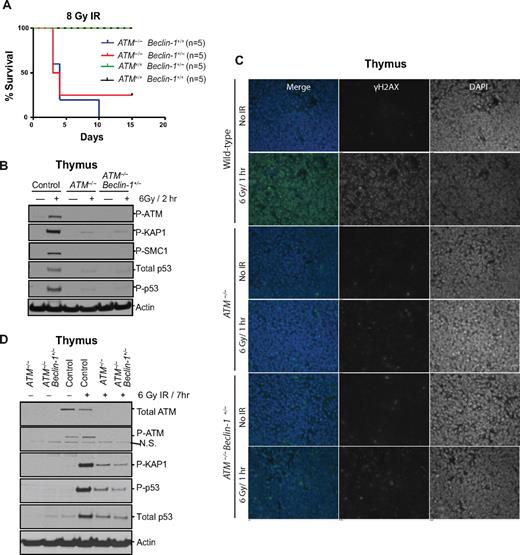 Figure 4. Allelic loss of Beclin-1 does not affect DNA damage responses. (A) Both ATM−/− and ATM−/− Beclin-1+/− mice display radiosensitivity. Survival of control, ATM−/−, and ATM−/− Beclin-1+/− mice exposed to 8-Gy total body irradiation is shown (P = .85 between ATM−/− and ATM−/− Beclin-1+/− mice, log-rank (Mantel-Cox) test. (B-D) The DDR pathway is equally defective in ATM−/− and ATM−/− Beclin-1+/− mice. (B) Immunoblotting of total protein, phosphorylation status, or both of various ATM substrates, including P-KAP1, P-SMC1, total p53, P-p53, and P-ATM itself in thymocytes from mice sacrificed 2 hours after being exposed to 6-Gy irradiation. Actin was used as loading control. (C) Thymic tissues were isolated from nonirradiated or whole body–irradiated animals (6 Gy/1 hour) and embedded in paraffin followed by immunofluorescence staining against the genomic instability marker γH2AX (green). 4,6-diamidino-2-phenylindole (blue) was used to visualize nuclei (magnification, 40×0.055). (D) The lack of rescue of the DDR abnormalities by Beclin-1 heterozygosity is not because of a delay of DDR signaling. Animals were irradiated with 6 Gy, and tissues were harvested 7 hours later followed by isolation of total proteins from thymocytes. The expression or phosphorylation status of proteins involved in DDR (P-KAP, total-p53, P-p53, and P-ATM) was analyzed. Both ATM−/− and ATM−/− Beclin-1+/− thymocytes showed a mild increase in the levels of proteins involved in DDR (P-KAP, total-p53, and P-p53) compared with cells exposed for 2 hours (B), but no difference was observed between these 2 genotypes at this time point (D). Actin served as loading control.