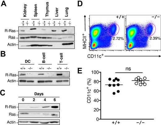 Figure 2. R-Ras expression in immune cells. (A) WT (+/+) and R-Ras knockout (−/−) organs were isolated, and total cell extracts were subjected to Western blotting analysis with the indicated antibodies. (B) WT (+/+) and R-Ras knockout (−/−) spleen was dissociated and subjected to cell sorting with DC-, B cell–, and T cell– specific markers. Western blotting analysis was carried out using an R-Ras specific antibody. (C) Bone marrow progenitors from 6- to 8-week-old mice were cultured in the presence of GM-CSF for 6 days. Cells were monitored throughout the DC differentiation process for R-Ras expression by Western blotting. Parallel membranes were probed with an anti–Ras monoclonal antibody (Millipore). Actin was used as a protein loading control. (D) Age-matched spleens from Rras+/+ and Rras−/− mice were harvested and analyzed for the percentage of MHC class II+CD11c+ DCs. (E) Day 6 BM-DC cultures from Rras+/+ (n = 9) and Rras−/− (n = 9) mice were analyzed for the percentage of CD11c+ DCs. ns indicates not significant. Results are representative of 3 independent experiments.