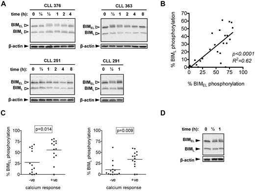 Figure 1. Induction of BIM phosphorylation after stimulation with anti-IgM. (A) CLL samples were treated with 20 μg/mL anti-IgM for the indicated times, and expression of BIM and β-actin was analyzed by immunoblotting. BIMEL and BIML isoforms are indicated by closed arrowheads. Open arrowheads indicate phosphorylated forms. Data are representative of a total of 28 samples analyzed and illustrate the various patterns of BIMEL/BIML phosphorylation observed in this cohort. For example, CLL 376 shows > 5% increased phosphorylation of both BIMEL and BIML, whereas CLL 363 shows increased > 5% phosphorylation of BIMEL only. CLL 251 shows no response and CLL 291 has > 5% basal phosphorylation of BimEL and BimL, which increased after stimulation. (B) Correlation between maximum anti-IgM–induced BIMEL phosphorylation and BIML phosphorylation. Results of linear regression are shown. (C) Correlation between maximum anti-IgM–induced BIMEL/BIML phosphorylation and intracellular Ca2+ responses. (D) Normal B cells were treated with anti-IgM for half an hour or 1 hour, and expression of BIM and β-actin was analyzed by immunoblotting. Results are representative of 3 different B-cell preparations.