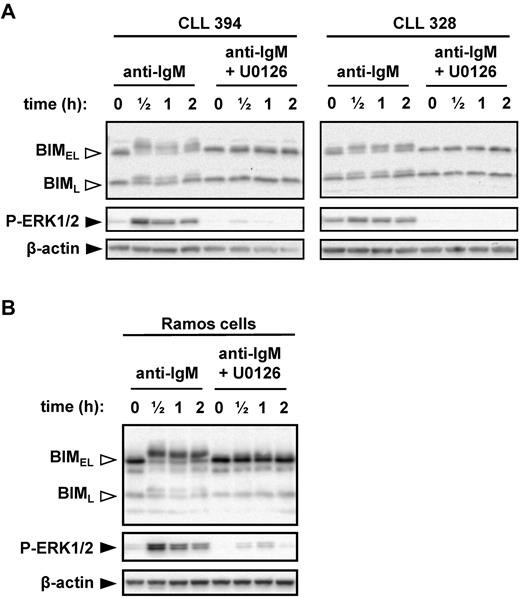 Figure 4. MEK1/2-dependent induction of BIM phosphorylation after stimulation with anti-IgM. (A) CLL samples and (B) Ramos cells were cultured in the presence or absence of U0126 (10μM) for 1 hour before stimulation with anti-IgM. Expression of BIM, phospho-ERK1/2, and β-actin was analyzed by immunoblotting. Open arrowheads indicate phosphorylated BIM forms. Data are representative of a total of 6 CLL samples and 3 independent Ramos cell experiments.