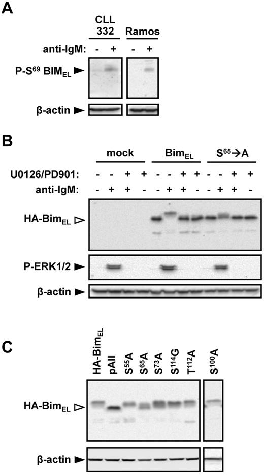 Figure 5. Identification of BIMEL phosphorylation sites in CLL and Ramos cells. (A) Ramos and CLL 332 cells were treated with anti-IgM for 30 minutes. Expression of S69-phosphorylated BIM and β-actin was analyzed by immunoblotting. (B) Ramos cells were transfected with wild-type rat HA-tagged BIMEL or S65 → A mutant rat HA-BIMEL expression plasmids, or were mock transfected as a control. After 24 hours, cells were treated with anti-IgM in the presence or absence of U0126 and PD0325901. Expression of HA-tagged BIM, phospho-ERK1/2, and β-actin was analyzed 30 minutes after IgM stimulation by immunoblotting. Open arrowheads indicate phosphorylated BIM. Data are representative of 3 independent experiments. (C) Ramos cells were transfected with wild-type rat HA-BIMEL or mutant rat HA-BIMEL expression plasmids and 24 hours later treated with anti-IgM. After 30 minutes, expression of HA-tagged BIM and β-actin was analyzed by immunoblotting. Open arrowheads indicate phosphorylated BIM. Data are representative of 3 independent experiments. pAII indicates rat HA-BIMEL with combined mutations at amino-acid residues 55, 65, 73, 100, 112, and 114.
