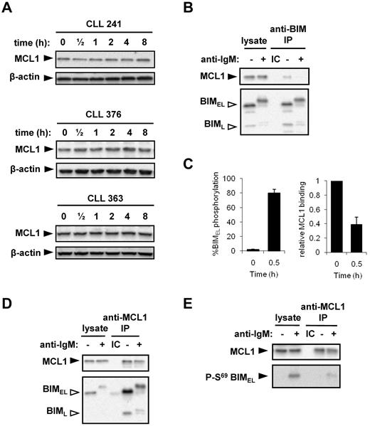 Figure 6. BIM phosphorylation and binding to MCL1. (A) CLL samples were treated with 20 μg/mL anti-IgM for the indicated times, and expression of MCL1 and β-actin was analyzed by immunoblotting. Figure shows results obtained with 3 CLL samples and is representative of a total of 6 samples. (B) Ramos cells were incubated in the presence or absence of anti-IgM for 30 minutes. Lysates were prepared and immunoprecipitations (IP) performed using an anti-BIM antibody or an isotype control (IC). The immunoprecipitates and a portion of the lysates were analyzed by immunoblotting using antibodies specific for MCL1 or BIM, as indicated. Open arrowheads indicate phosphorylated BIM isoforms. (C) Quantitation of BIMEL phosphorylation and the proportion of MCL1 associated with BIM in Ramos cells treated with anti-IgM for 30 minutes. The amount of MCL1 bound to BIM in unstimulated cells was set to 1.0. Data are derived from 6 independent experiments (mean ± SD). (D) Ramos cells were incubated for 30 minutes with or without IgM stimulation. The IP was performed using rabbit anti-MCL or the appropriate IC, and the precipitates/cell lysates were probed with anti-BIM and anti-MCL1 antibodies. (E) IP was performed with a mouse anti-MCL1 antibody or the appropriate IC, to enable immunoblotting with a rabbit S69 phospho-BIM–specific antibody. (D-E) Data are representative of 3 independent experiments.