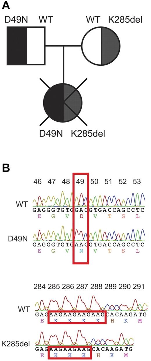 Figure 1. Identification of biallelic perforin mutations inherited by a female patient presenting with HLH. (A) Family tree indicating the perforin phenotype in each member of the patient's family. (B) Comparison of the perforin gene sequence of the patient and a normal WT control. One mutation was G145 > A, mapping to exon 2, and resulting in the substitution of aspartate 49 by asparagine (D49N), whereas the other was a deletion of nucleotides 853 to 855 in exon 3, resulting in the in-frame deletion of lysine 285 (K285del).