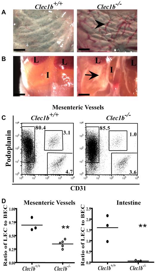 Figure 1. Clec1b−/− newborn pups are nonviable and visually distinct from Clec1b+/+ littermates at birth. (A) Blood-filled lymphatic vessels (black arrowhead) in the subcutaneous region of the skin persist at P0 (scale bar = 500 μm). (B) Clec1b−/− newborn pups that feed develop chylous ascites (black arrow) in the abdominal cavity (L indicates lobes of the liver; I, intestine; scale bar = 1 mm). (C) Example of flow cytometric analysis identifying LECs (podoplanin+CD31+) and BECs (podoplanin−CD31+) in the stromal fraction (CD45−Ter119−) of mesenteric vessel preparations from Clec1b+/+ (left) and Clec1b−/− (right) offspring. (D) Ratio of LECs to BECs in preparations of isolated mesenteric vessels (left; **P = .002 by unpaired t test; n = 3 Clec1b+/+; n = 5 Clec1b−/−) and intestine (right; **P = .012 by unpaired t test; n = 3 for each genotype) show significant decreases in P0 Clec1b−/− offspring.