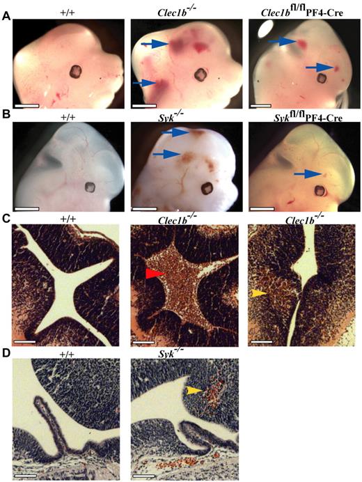 Figure 3. Abnormal hemorrhage within the developing central nervous system of Clec1b−/− and Syk−/− mice from E12.5. (A) Both constitutive (Clec1b−/−; middle; n = 18 of 19) and platelet/megakaryocyte-specific (Clec1bfl/flPF4-Cre; right; n = 3 of 5) ablation of Clec1b results in hemorrhaging within the brain and developing spinal column (blue arrows). (B) Constitutive (Syk−/−; middle; n = 13 of 14) and platelet/megakaryocyte-specific (Sykfl/flPF4-Cre; n = 10 of 13) ablation of Syk presented with a similar hemorrhaging phenotype in similar regions as the Clec1b−/− embryos (blue arrows). None of the littermate wild-type controls (+/+; left; n ≥ 5) showed this phenotype. Scale bars = 1 mm. (C) H&E-stained sections from E12.5 brains show that hemorrhages in Clec1b−/− embryos were localized to at least 1 ventricle (middle; red arrowhead) and within the parenchyma (right; yellow arrowhead). (D) Sections from E12.5 Syk−/− embryos showed no hemorrhaging in the ventricles, but consistent hemorrhaging in the parenchyma (middle; yellow arrowhead). None of the wild-type controls showed hemorrhaging in any section (left). Scale Bars = 100 μm.