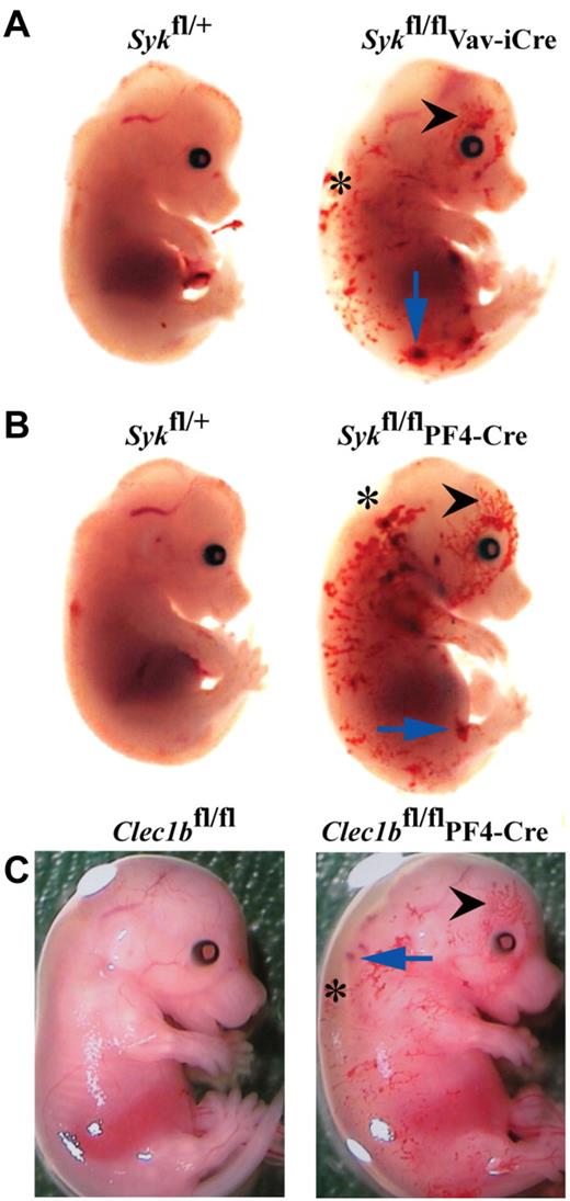 Figure 4. Hematopoetic and platelet-specific deficiency of Syk and Clec1b result in defective lymphatic development. The phenotypes of (A) Sykfl/flVav-iCre, (B) Sykfl/flPF4-Cre, and (C) Clec1bfl/flPF4-Cre embryos at E14.5 are indistinguishable and include edematous swelling (asterisk), hemorrhages (blue arrow) and blood-filled lymphatics in the skin (black arrowhead). This phenotype is not seen in control littermates. The figures shown are representative of > 5 embryos of each genotype.