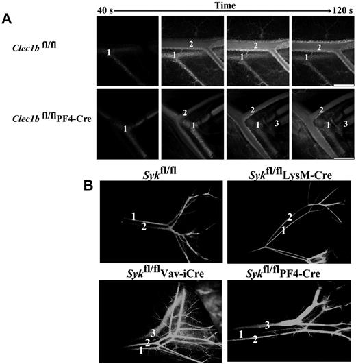 Figure 5. Disruption of Clec1b or Syk in the megakaryocyte/platelet lineage results in interconnection of the blood and lymphatic vasculatures. (A) FITC-dextran was injected into an anesthetized mouse via a carotid cannula after exteriorization of the abdominal mesentery. In both Clec1bfl/fl (top) and Clec1bfl/flPF4-Cre (bottom) FITC-dextran was initially visualized in the artery (1) followed shortly by the vein (2). In the Clec1bfl/flPF4-Cre mice FITC-dextran was visualized in the mesenteric lymphatic vasculature (3) shortly after the flowing through the vein. This phenomenon was never seen in the Clec1bfl/fl mice. Scale bar = 0.5 mm. This figure is representative of 3 experiments. (B) FITC-dextran was injected into the left ventricle of the heart of mice of the indicated genotypes, and vessels in the gut were visualized for FITC fluorescence 60 seconds later. FITC-dextran was only detected in the systemic blood circulation (1 and 2) of Sykfl/fl (top left) and Sykfl/flLysM-Cre mice (top right). In contrast, leakage of the FITC-dextran into the gut mesenteric lymphatic vasculature (3) was detected in Sykfl/flVav-iCre (bottom left) and Sykfl/flPF4-Cre (bottom right).