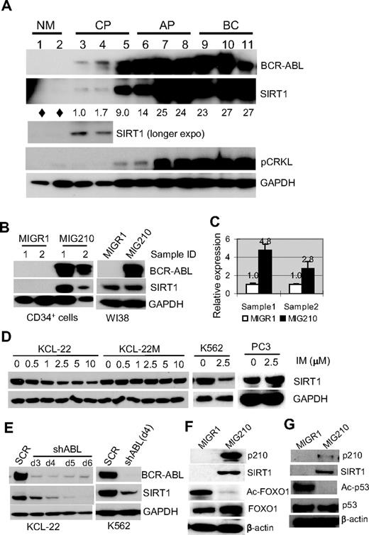 Figure 1. BCR-ABL expression activates SIRT1 in human hematopoietic progenitor cells. (A) SIRT1 protein in CD34+ normal and CML cells. Chronic phase (CP) and advanced-phase CML (AP, accelerated phase; BC, blast crisis) were from unrelated patients with active disease. Normal CD34+ cells (NM) were from the peripheral blood of healthy adult donors after BM mobilization by GM-CSF treatment. Three CP patients had not received prior treatment. AP and BC patients received IFN, hydroxyurea, or combination treatment and samples were obtained after at least 2 weeks off chemotherapy, with the exception that BC patient 9 had not received prior treatment. Densitometry of SIRT1 expression was quantified after normalizing to GAPDH. Diamonds indicate no significant reading above background. (B-C) SIRT1 protein (B) and mRNA (C) levels after BCR-ABL transduction (MIG210) in normal CD34+ cells from 2 independent healthy donors compared with transduction of WI38 cells. Empty vector MIGR1 was used as a control. (D) Change of SIRT1 protein levels on imatinib (IM) treatment for 48 hours in the CML cell lines KCL-22, K562, and KCL-22M, and in prostate cancer PC3 cells. (E) SIRT1 expression on BCR-ABL knockdown by shABL lentiviral vector at 3-6 days after initial transduction. SCR indicates scrambled shRNA. (F) Representative Western blot analysis of FOXO1 acetylation change in CD34+ cells after MIG210 transduction. (G) Representative Western blot analysis of p53 acetylation. CD34+ cells were treated with 10μM nutlin-3 and 0.5μM trichostatin A for 6 hours, followed by p210 transduction.