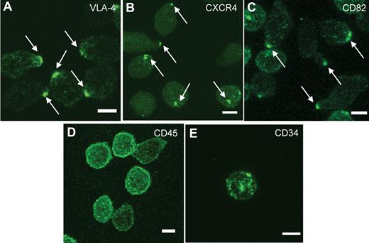 Figure 1. A polarized membrane domain is found on normal human HSPCs. (A-E) Immunofluorescence labeling of human MPB CD34+ cells from a normal volunteer with antibodies for VLA-4 (A), CXCR4 (B), and CD82 (C) shows a polarized distribution of the membrane proteins on the majority of the cells, whereas CD45 (D) and CD34 (E) are distributed uniformly on the plasma membrane. These images are representative of the polarized molecule phenotypes observed in more than 100 CD34+ cells. Scale bars in panels A through E equal 5 μm.