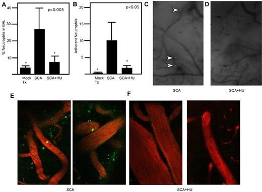 Figure 3. HU attenuates neutrophil adhesion and migration. (A) Neutrophil recruitment to the lung in response to killed pneumococci administered intratracheally was quantitated by FACS of bronchoalveolar lavage from saline- and HU-treated SCA mice 6 hours after challenge (n = 6 mice/group; PBS 26.2 ± 16.8, HU = 5.16 ± 3.00; * P < .05 compared with SCA by Mann-Whitney). Data represent percentage of total cells isolated from bronchoalveolar lavage. (B) SCA mice ± HU were exposed to intravenous TNFα to induce endothelial activation and neutrophil margination. Neutrophil adherence was quantitated in cranial windows (5 minutes at ×40 per mouse for at least 4 mice/group; *P < .05 compared with SCA by Mann-Whitney). (C-D) Representative images through cranial windows on SCA (C) or SCA + HU (D) mice. Neutrophils indicated by arrows, ×10 magnification. (E-F) Representative images of GFP neutrophils (green) imaged by 2-photon microscopy in the rhodamine-dextran–labeled vasculature (red) of SCA mice (E) and SCA mice treated with HU (F).