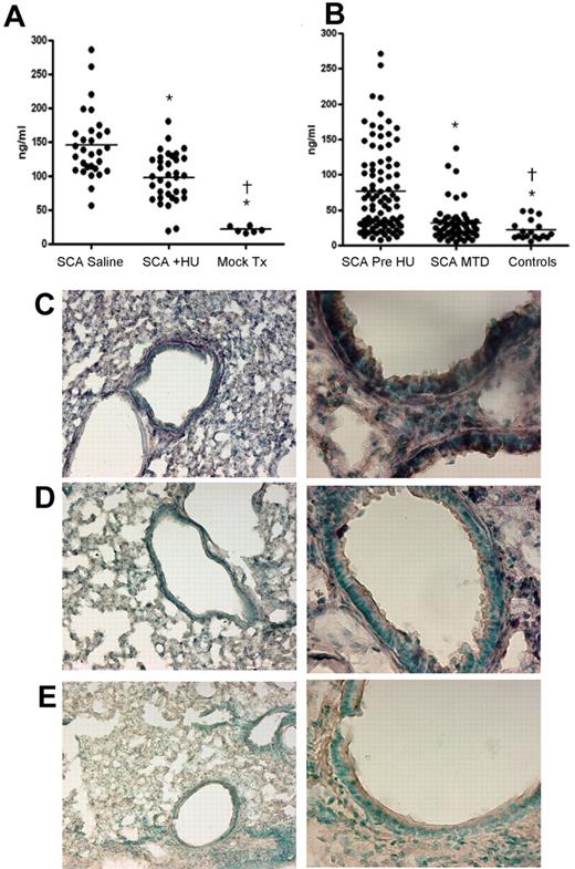 Figure 4. Effect of HU on E-selectin levels in lung and serum. (A) Measurements of soluble E-selectin in the serum of mice (SCA saline, n = 30, mean = 145 ± 45 ng/mL; SCA + HU, n = 35, mean = 98.5 ± 35.5 ng/mL). (B) Measurements of soluble E-selectin in the serum of humans (SCA/pre-HU, n = 92, mean = 77 ± 60; SCA/MTD, n = 57, mean = 31 ± 26; healthy controls, n = 18, mean = 22 ± 14) undergoing HU therapy. All groups significantly different (P < .001) from all other groups by 2-tailed t test (*compared with SCD mock; †compared with SCD + HU). (C-E) Representative sections of lung stained for E-selectin (purple) from SCA animals receiving saline (C), HU (D), or a negative control with no primary antibody (E). Magnification: left column, ×4; right column, ×10.
