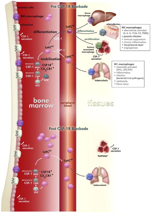 Figure 2. CSF-1 regulation of macrophage development in the mouse and the effects of prolonged M279 anti–CSF-1R mAb treatment. HSCs give rise to common myeloid precursors, which generate monocyte-DC precursors that in steady state give rise to DC precursors and CSF-1R+Ly6Chi and CSF-1R+Ly6Clo monocytes. Monocytes enter the circulation from the marrow and are signaled to exit the blood to contribute to inflammatory processes (CSF-1R+Ly6Chi) or to take up residence in specific locations (CSF-1R+Ly6Clo). CSF-1 is a critical regulator of the differentiation, proliferation, and survival of CSF-1R+Ly6Clo monocyte-derived tissue macrophages, alternatively activated macrophages, and tumor-associated macrophages. The cellular sources of CSF-1 are primarily mesenchymal in origin, but macrophages and tumors can also secrete this cytokine. Treatment with CSF1R blocking antibody M279 selectively depleted the CSF-1R+Ly6Clo monocyte precursor of resident tissue macrophages, whereas CSF-1R+Ly6Chi inflammatory monocytes were increased. Within tissue, the M279 mAb may prevent differentiation and proliferation of resident macrophage populations and tumor-associated macrophages.