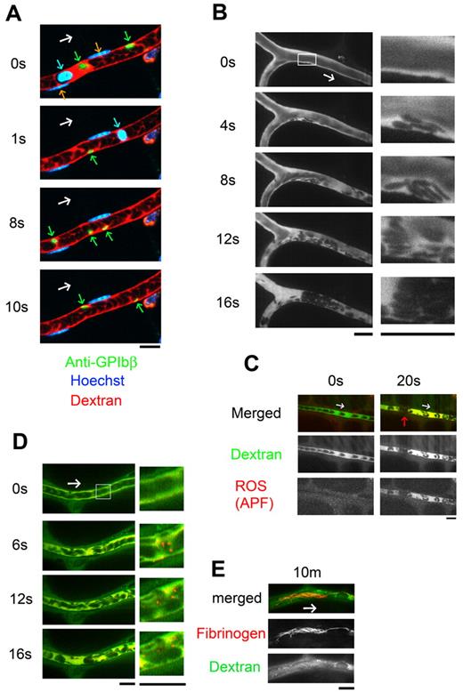 Figure 1. Thrombus formed by discoid platelets visualized by in vivo imaging after laser/ROS-induced injury. (A) In vivo imaging enabling selective visualization of multiple cell types. Platelets, erythrocytes, and leukocyte/EC nuclei were visualized with an anti-GPIbβ antibody (green), fluorescent dextran (red), and Hoechst 33 342 (blue), respectively, in mesenteric capillaries of 12-week-old male control mice. Correspondingly colored arrows point to each cell type, and the white arrow indicates the direction of blood flow. (B) Discoid platelets contribute to thrombus formation after laser/ROS-induced injury. The microcirculation of the mesentery in living animals was visualized after laser/ROS-induced initiation of thrombus formation. (C) ROS production triggers thrombus formation. ROS production in the affected blood vessel after laser/ROS-induced injury was visualized by the administration of APF (red) with dextran (green). The red arrow indicates the developing thrombus. Original movies for panels A and B are available as supplemental Videos 1 and 2. (D-E) Distrbution of fibrinogen in a developing thrombus after short-term (D, 0-20 seconds) and long-term (E, 10 minutes) laser-induced injury. Injected fluorescent fibrinogen is shown in red, and dextran is in green. All scale bars are 10 μm.