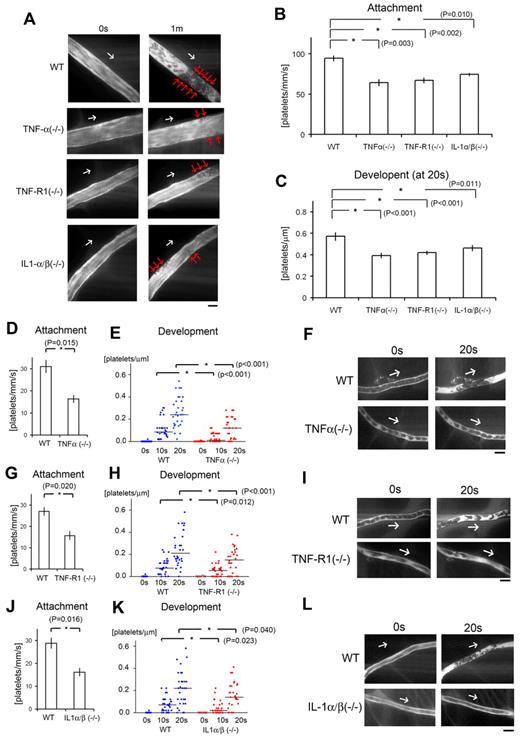Figure 2. Inflammatory cytokines are key components for discoid platelet attachment and thrombus development in our laser/ROS-induced injury model. (A) In vivo imaging of thrombus formation in small-sized mesenteric arterioles of 12-week-old male TNF-α KO, TNF-R1 KO, and IL-1-α/β double KO mice and wild-type (WT) controls. The red arrows show the developing thrombi, and white arrows show the direction of blood flow. Numbers of platelets attached to the vessel wall 10 seconds after laser/ROS-induced injury (B) and numbers of platelets within the developing thrombus 20 seconds after injury (C) in each mouse type. The initial attachment of platelets to ECs after laser/ROS-induced injury was significantly diminished in all inflammatory cytokine KO mice, as was thrombus development. (D-L) Numbers of platelets attached to the vessel wall 10 seconds after laser/ROS-induced injury (D,G,J) and numbers of platelets within the developing thrombus 0 seconds, 10 seconds, and 20 seconds after injury (E,H,K) in mesenteric capillaries of 12-week-old male TNF-α (D-E) and TNF-R1 (G-H) KO mice, IL-1-α/β double KO mice (J-K), and their respective WT littermates. (F,I,L) In vivo imaging of thrombus formation within capillaries of TNF-α KΟ, TNF-R1 KO, and IL-1-α/β double KO mice and WT mice. The white arrows show the direction of blood flow. Both “attachment” and “development” were diminished in all inflammatory cytokine KO mice. Horizontal lines denote median values (E,H,K). (n = 30 vessels from 5 animals for each group). All scale bars are 10 μm.