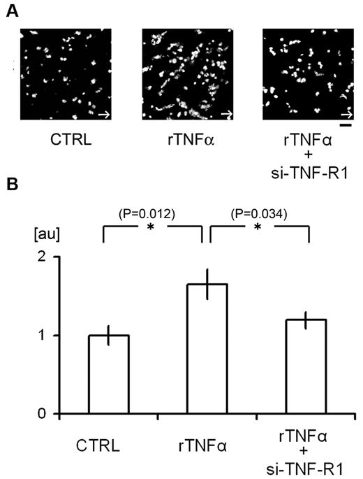 Figure 5. Flow chamber analysis of the contribution of TNF-α signaling to platelet attachment to HUVECs. (A-B) Attachment of human platelets to cultured HUVECs. Some cells were treated with si-TNF-R1 48 hours before the experiments; CTRL denotes HUVECs treated with control scrambled si-RNA. Some cells were also treated with human rTNF-α (24 hours, 10 ng/mL). After perfusing tetramethylrhodamine ethyl ester–stained platelets with Tyrode buffer for 5 minutes at 200 dynes/cm2, adherent platelets were visualized (A). White arrows denote the direction of flow. The numbers of adherent platelets were quantified and normalized to the number obtained using CTRL cells (B). AU denotes arbitrary units. (n = 15 experiments for each group). Asterisks indicate statistical significance (P < .05). Scale bar is 10 μm.