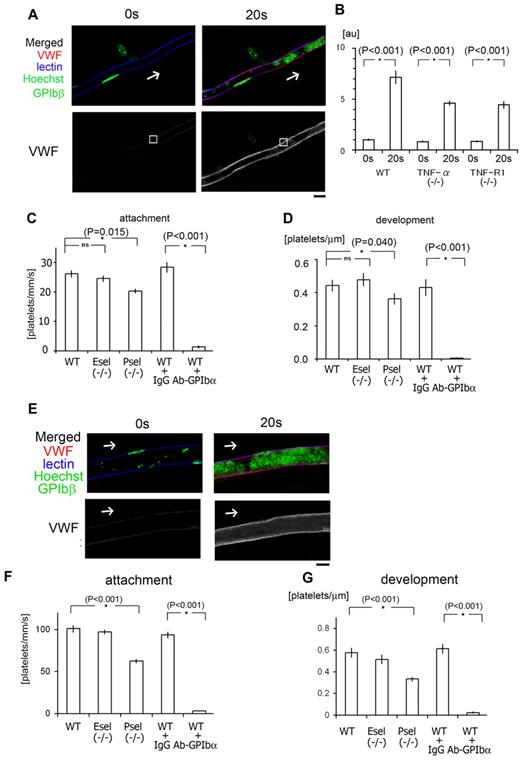 Figure 6. Binding of endothelial VWF to platelet GPIb plays a pivotal role in our laser/ROS-induced thrombosis model in both capillaries and arterioles. (A) In vivo imaging of VWF mobilization to the EC surface of small capillaries. Fluorescent anti-VWF antibody (red) was administrated to wild-type mice and visualized before and after laser/ROS-induced injury. VWF is expressed on the EC surface within the affected vessel after laser/ROS-induced injury. The cells were also costained with lectin (blue, vasculature), anti-GPIbβ (green, platelets), and Hoechst (green, nucleus). (B) Relative change in anti-VWF signals after laser/ROS-induced thrombus formation in wild type (WT), TNF-α KO, and TNF-R1 KO mice. Anti-VWF signal intensity was determined in the EC surface regions (white boxes in panel A) before (0 seconds) and 20 seconds after laser/ROS-induced injury. Note that VWF expression on endothelium after laser/ROS-induced injury was significantly reduced in both KO mice. AU denotes arbitrary units (n = 15 vessels from 5 animals). Representative original VWF images are shown in supplemental Figure 7. Asterisks indicate statistical significance (P < .05). (C) Numbers of platelets attached to vessel walls 10 seconds after laser/ROS-induced injury in WT, P-selectin KO (P-sel−/−), and E-selectin KO (E-sel−/−) mice, as well as WT mice treated with control IgG (WT + IgG), or neutralizing anti-GPIbα antibody (WT + Ab-GPIbα). Numbers of attached cells were markedly reduced in anti-GPIbα–treated WT mice (n = 30 vessels from 5 animals in each group). (D) Calculated numbers of platelets in developing thrombi 20 seconds after laser/ROS-induced injury (n = 30 vessels from 5 animals for each group). (E) Visualization of VWF mobilization to the EC surface in small arterioles, performed as in A. (F-G) Quantification of initial platelet attachment and thrombus development after laser injury in small arterioles (n = 30 vessels from 5 animals in each group). Asterisks indicate statistical significance (P < .05). The scale bar is 10 μm.