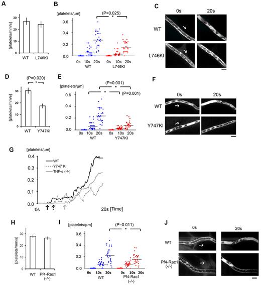 Figure 7. αIIbβ3 integrin signaling and actin cytoskeletal remodeling are required for stabilization of developing thrombi in vivo. (A) Numbers of platelets attached to the vessel wall 10 seconds after laser/ROS-induced injury in L746A KI mice and their wild-type (WT) littermates (n = 30 vessels from 5 animals in each group). (B) Calculated numbers of platelets within developing thrombi 0 seconds, 10 seconds, and 20 seconds after laser/ROS-induced injury. (C) Representative in vivo imaging after laser injury (n = 30 vessels from 5 animals in each group). Scale bar is 10 μm. Asterisks indicate statistical significance (P < .05). (D-F) Thrombus formation in Y747A KI mice and their WT littermates. The experimental protocols were the same as in panels A-C. Note that thrombus formation is more severely impaired in Y747A KI mice than L746A KI mice. (G) Representative curve showing the numbers of platelets in a developing thrombus after laser/ROS-induced injury in wild-type (WT, black line), TNF-α KO (gray line), and Y747A KI (dotted line) mice. Arrows in each line show the time of initial platelet attachment to the endothelium. (H-J) Impaired thrombus formation in Pf4-Rac1 KO mice. Platelet attachment (H) and thrombus development (I) after laser/ROS-induced injury was quantified, and in vivo images are shown (J). Horizontal lines denote median values (B,E,I).