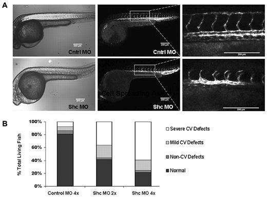 Figure 1. Shc is required for intersegmental vessel sprouting angiogenesis in zebrafish. (A) Shc protein depletion in Tg(kdrl:egfp) zebrafish embryos results in defective angiogenesis 30 hours after fertilization. Representative images of trunk vasculature are shown, with anterior on the left. Shc-MO fish exhibited a range of vascular phenotypes, the most common being delayed or defective intersomitic vessel sprouting and growth dorsally from the aorta. Scale bars indicate 200 μm. (B) Quantification of phenotypes observed in all living fish at 30 hours after fertilization displayed as a percentage of total. Control 4× MO, n = 118; Shc 2× MO, n = 72; and Shc 4× MO, n = 105 embryos. Numbers indicate all fish counted from 3 independent experiments.