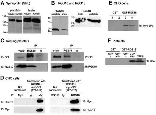 Figure 1. Formation of an SPL/RGS complex in resting platelets and CHO cells. (A) Western blot analysis of SPL in platelets and brain. Note that all 4 lysates were run on a single gel, and, indicated by the white line, a marker lane and an empty lane were excised. (B) Western blot analyses of RGS10 and RGS18 in lysates prepared from human platelets and human brain. The vertical white line indicates where an intervening lane was excised. (C) Platelet lysates were precipitated with anti-RGS10, anti-RGS18, or rabbit nonimmune immunoglobulin (Ig) and then probed as indicated. (D) Lysates were prepared from CHO cells cotransfected with RGS18 and Myc-tagged SPL (residues 177-817, Myc-SPL). Proteins were precipitated with anti-Myc, anti-RGS18, or nonimmune globulin (Ig), and then probed as indicated. Each example is representative of ≥ 2 experiments. (E) Lysates prepared from duplicate sets of CHO cells transfected with full-length Myc-SPL were incubated with GST (lanes 1 and 2) or GST-RGS18 (lanes 3 and 4). Proteins that became bound to glutathione beads were probed with anti-Myc. (F) Platelet lysates supplemented with GDP ± AlF4− as indicated were incubated with GST or GST-RGS18. Proteins that became bound to glutathione beads were probed with anti-Gqα. Experimental details are in supplemental Methods.