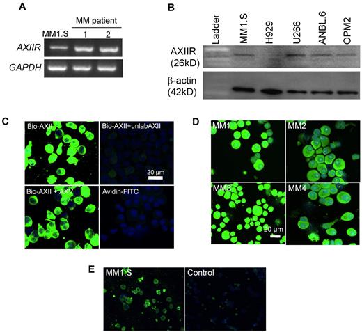 Figure 1. AXIIR is expressed by MM cells and CD138+ cells from MM patients. (A) RNA was extracted from CD138+ cells from MM patients (nos. 1, 2) and the MM1.S cell line. cDNA was reverse-transcribed and RT-PCR was performed with primers specific to AXIIR and GAPDH. (B) Total protein (20 μg) was extracted from MM cell lines and analyzed for AXIIR expression (AXIIR mouse Ab) by Western blotting. β-actin was used as a loading control. (C) MM1.S cells were incubated with 1 μg/mL bio-AXII alone or in the presence of either 100-fold molar excess unlabeled AXII (unlabAXII) or 100-fold excess annexin V (AXV). A secondary only control with avidin-FITC was included in the experiment. (D) CD138+ cells from MM patients (n = 4) were incubated with 1 μg/mL bio-AXII and after extensive washing were incubated with avidin-FITC. Staining was visualized using confocal microscopy. (E) MM1.S cells were incubated with AXIIR Ab (rabbit) at a 1:200 dilution. After extensive washing, the MM1.S cells were then incubated with Alexa Fluor 488. A set of experiments with an IgG control was performed. Staining was visualized using confocal microscopy.