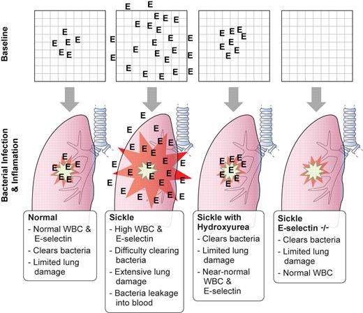 Baseline expression of E-selectin (represented by the frequency of “E” in each panel) affects the outcome of bacterial pneumonia challenge with Streptococcus pneumoniae. Professional illustration by Kenneth X. Probst.